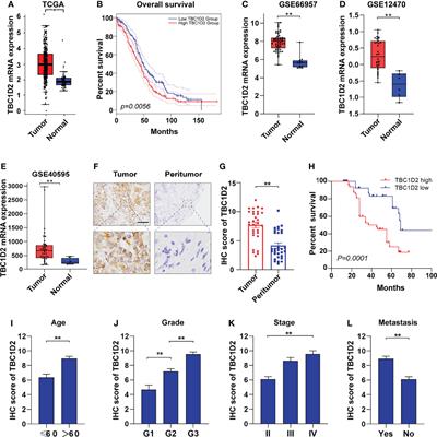 TBC1D2 Promotes Ovarian Cancer Metastasis via Inducing E-Cadherin Degradation